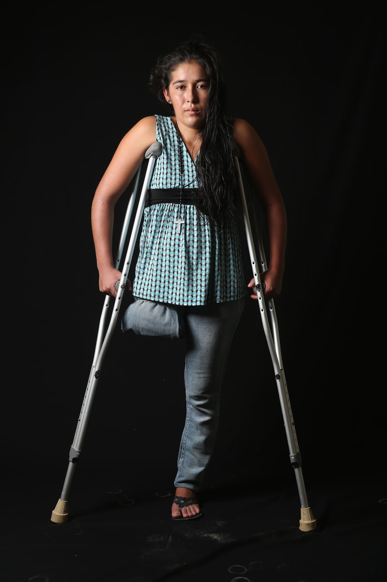 Elvira tiene 22 años y perdió su pierna al caer del tren 'La Bestia' mientras intentaba acercarse a la frontera entre México y Estados Unidos para migrar al norte. 
<br>