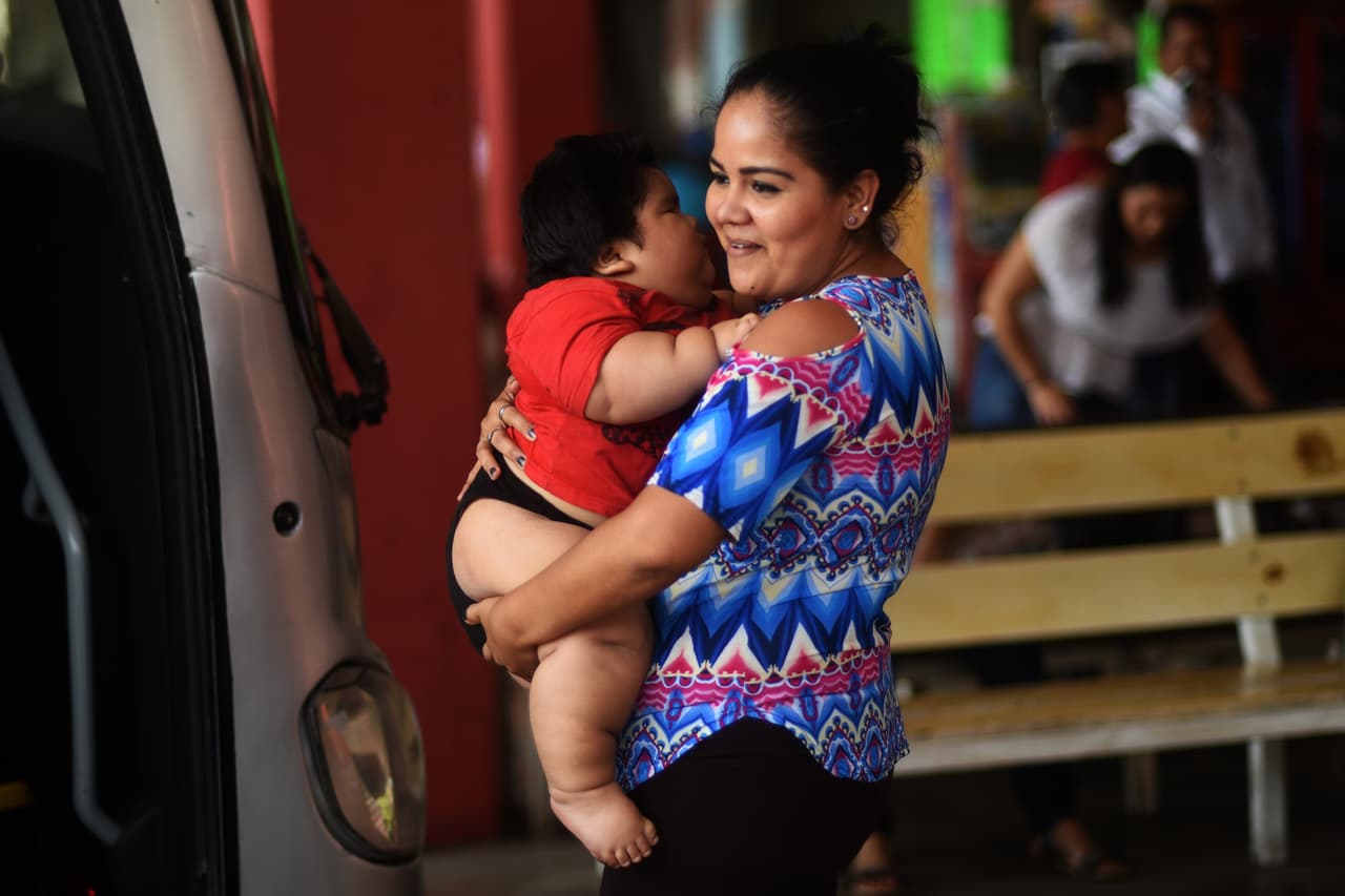 El bebé mexicano Luis Manuel Gonzales es casi como cualquier bebé de 10 meses pero una dramática diferencia pone en riesgo su vida: pesa 28 kilos. ‘Luisito’ nació el 15 de diciembre de 2016 con un peso de 7,7 libras (3,5 kilos) casi lo mismo que pesa su hermano Mario de tres años. A los dos meses, el bebé ya pesaba 22 libras (10 kilos) y en los siguientes ocho meses duplicó su peso.