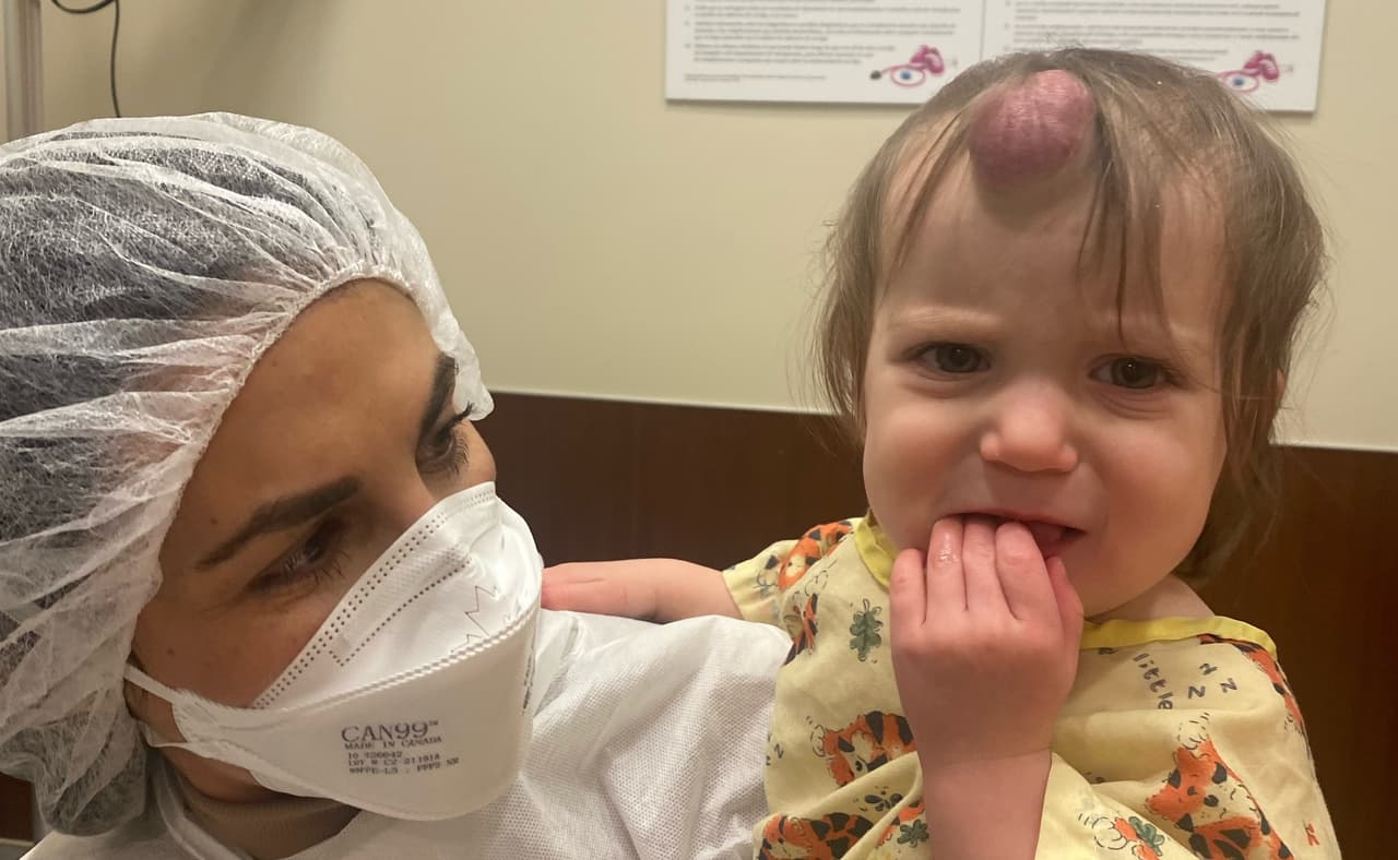 Del protuberante tumor que esta bebé tenía en la frente ya no queda rastro gracias a una cirugía