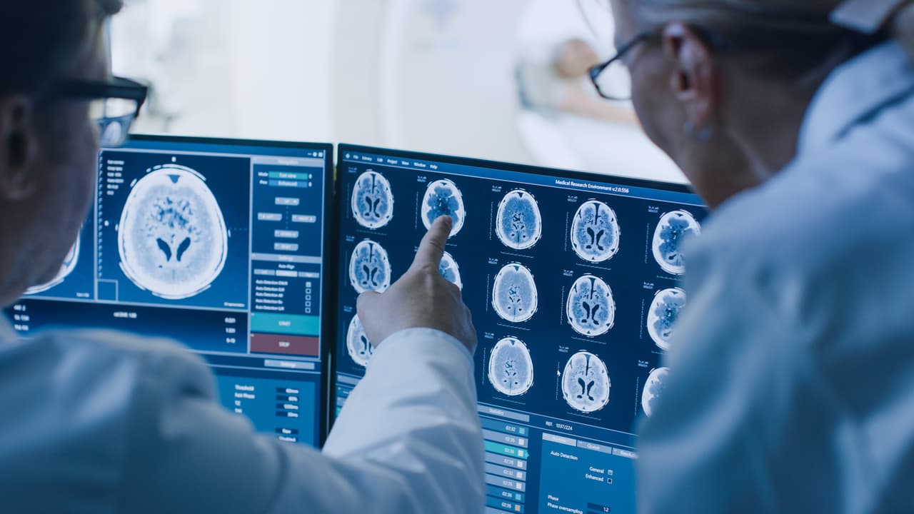 <h3 class="cms-H3-H3">13. Cáncer de cerebro y sistema nervioso</h3>
<br>
<br>🏥 
<b>Crecimiento en costo por caso de acuerdo con el Índice de Gastos Médicos: </b>4.12
<br>
<br>🏥 
<b>Aumento del gasto en los últimos 10 años registrados:</b> 64.1%