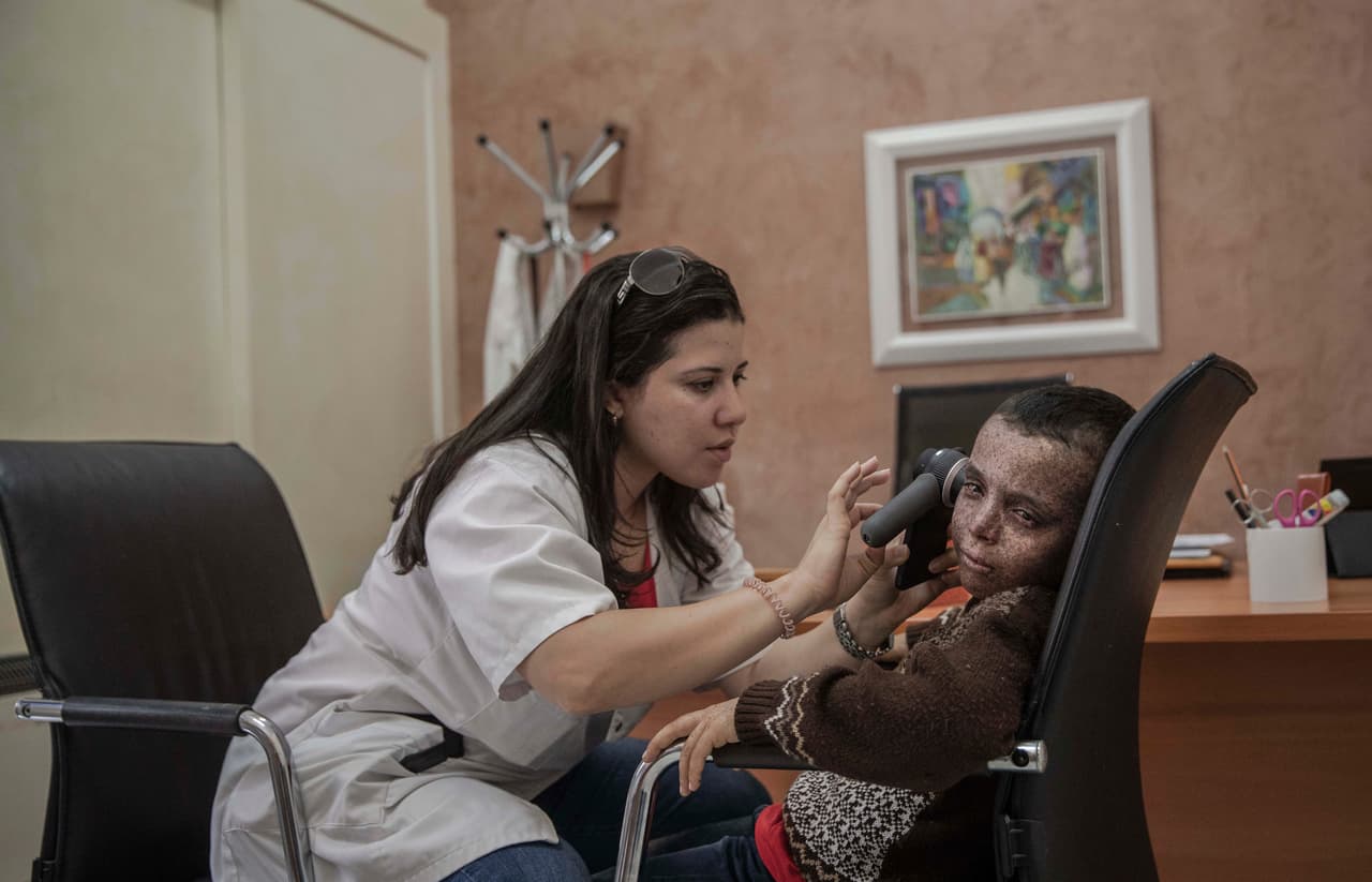 Las donaciones del grupo de Ghazaoui llegan a familias como las de Said El Mohamadi, una sastre en la ciudad de Salé, cuya hija de 6 años tiene la condición. Su familia todavía está debatiendo el tema de la escuela.