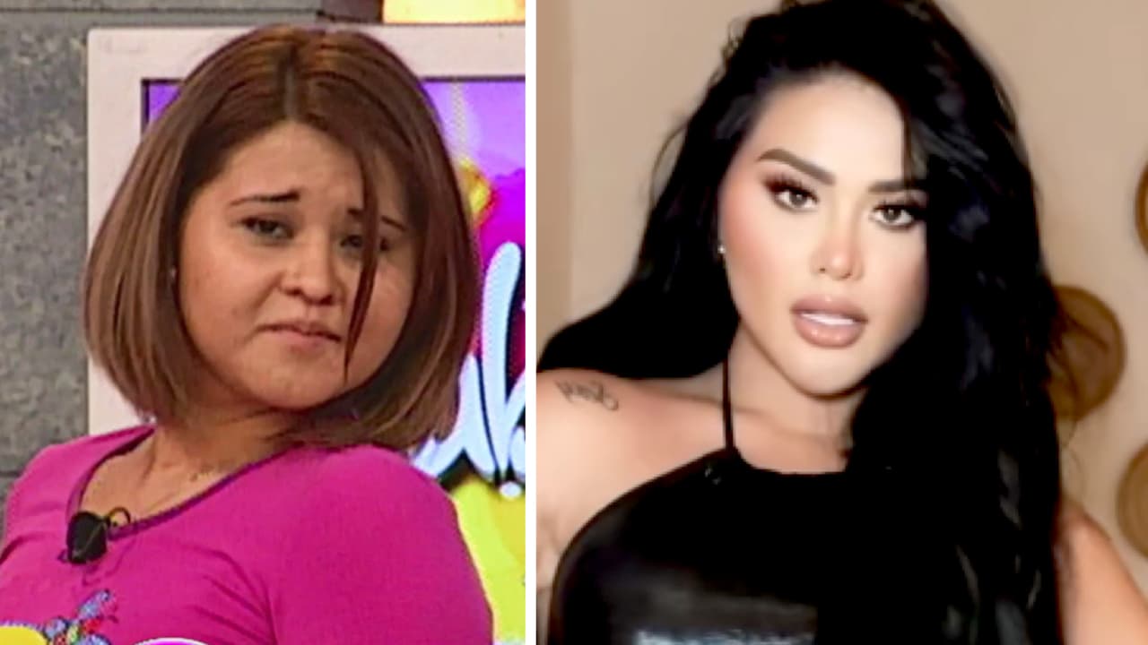 El antes y después de ‘Gomita’ tras sus cirugías: así se ve ahora