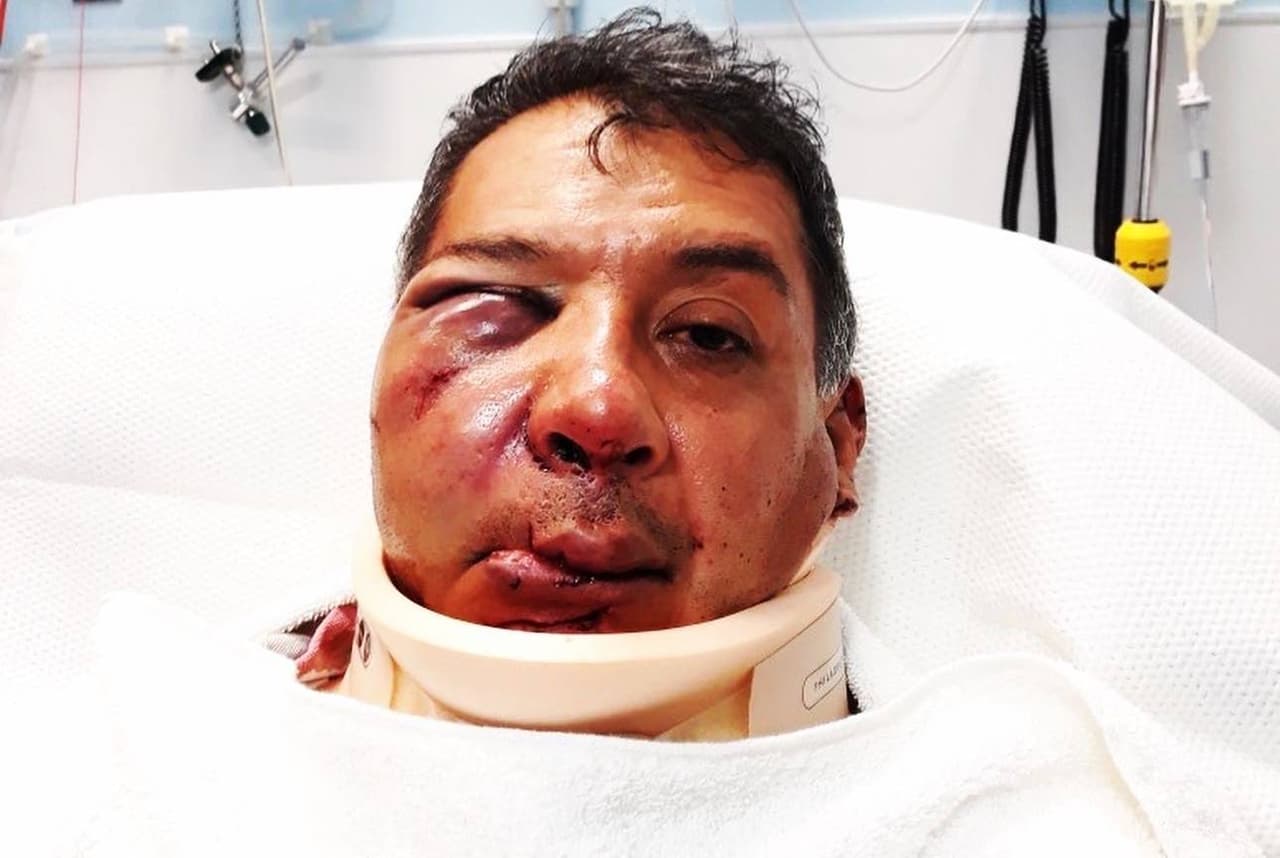 Oswaldo Refugio Sánchez, padre de tres hijos, salió como de costumbre a las calles de la zona de Marina del Rey, 
<b>entre las calles Lincoln y Maxella, para vender flores, cuando <a href="https://www.univision.com/local/los-angeles-kmex/me-dijo-que-me-iba-a-matar-vendedor-de-flores-queda-inconsciente-tras-ataque-con-objeto-de-metal-para-robarle">fue atacado por un afroestadounidense con un objeto de metal</a>. </b>El hecho ocurrió el pasado 12 de julio a las 4:30 p.m.