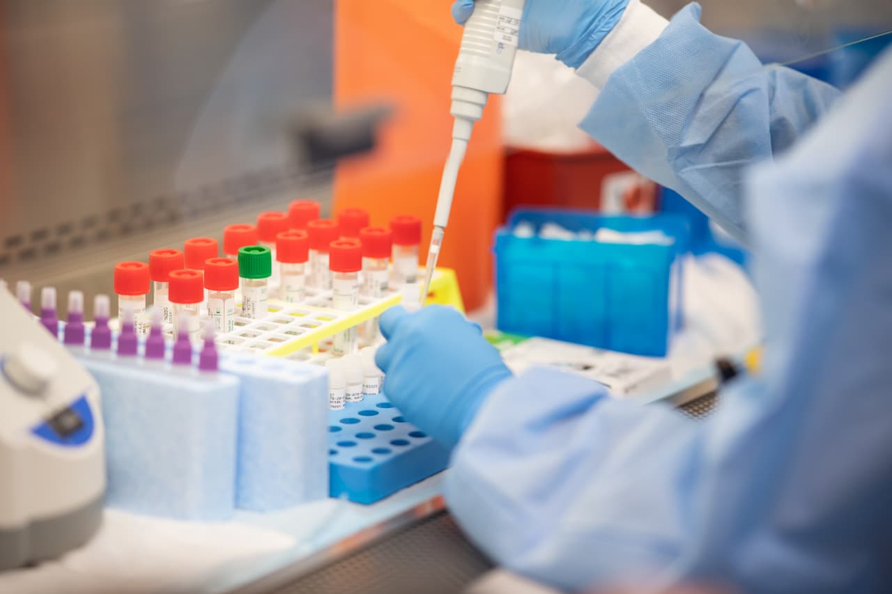 Personas mayores de 65 años o con enfermedades subyacentes pueden solicitar prueba de coronavirus