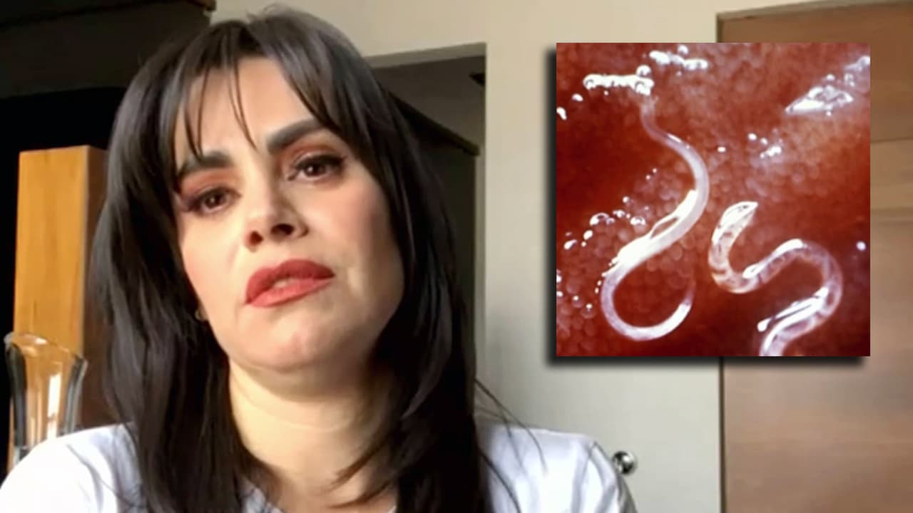 "Tienes larvas" en el rostro: Luz Elena González temió perder la vista y revive su experiencia de terror
