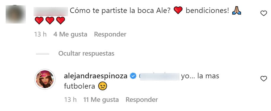 En respuestas que dio a otros usuarios insistió en que fue su habilidad "futbolera" la que la llevó a casi destrozarse la boca. 
<br>