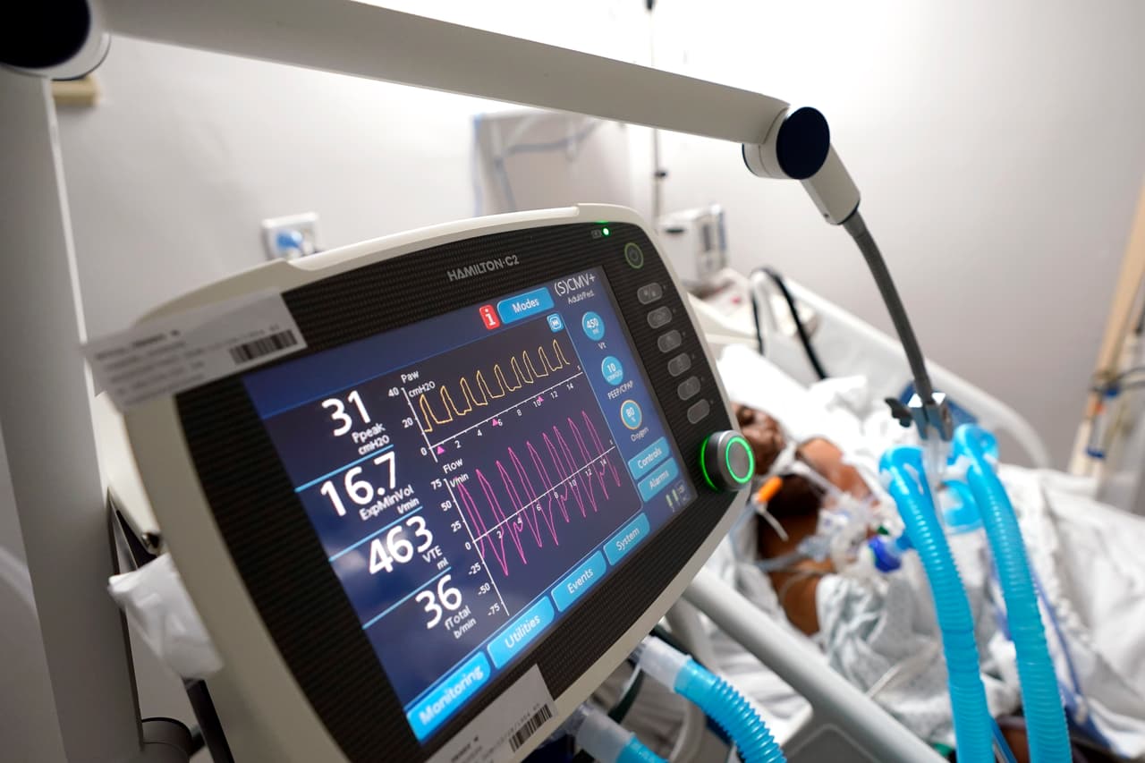 En Texas casi el 80% de las camas de hospital están ocupadas y las unidades de cuidados intensivos se están llenando en algunas de las ciudades más grandes del estado, incluidas San Antonio y Houston. En la fotografía un respirador mantiene con vida a un paciente delicado en la unidad de covid-19.