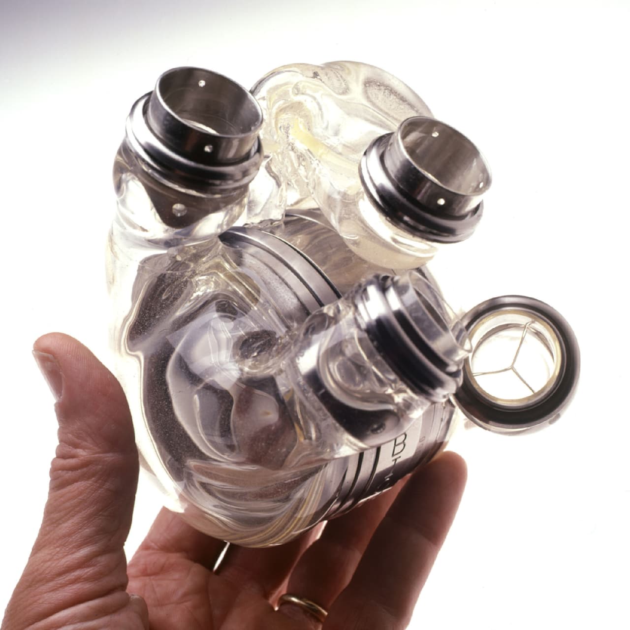 <b>Robot corazón. </b>Las máquinas que realizan las funciones cardiopulmonares durante las cirugías a corazón abierto existen desde hace varias décadas. Sin embargo, un dispositivo autónomo que hace la función del corazón y es tan pequeño que se instala la cavidad torácica del paciente es un desarrollo reciente. Abiomed, una compañía con sede en Danvers, Massachusetts, creó AbioCor: un robot de plástico y titanio conectado a una batería inalámbrica que se lleva en la muñeca. Robert Tools, un bibliotecario con insuficiencia cardíaca, recibió el primero el 2 de julio de 2001 en Louisville, Kentucky, y logró vivir cinco meses.