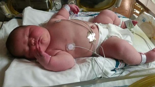 La mayoría de los niños se recupera en un plazo de 7 a 10 días. En raras ocasiones puede haber complicaciones como 
<a href="https://www.univision.com/noticias/salud/sepsis-ataque-cardiaco-o-neumonia-tres-formas-en-las-que-la-gripe-puede-matarte-video">neumonía</a>, meningitis o encefalitis.
<br>
