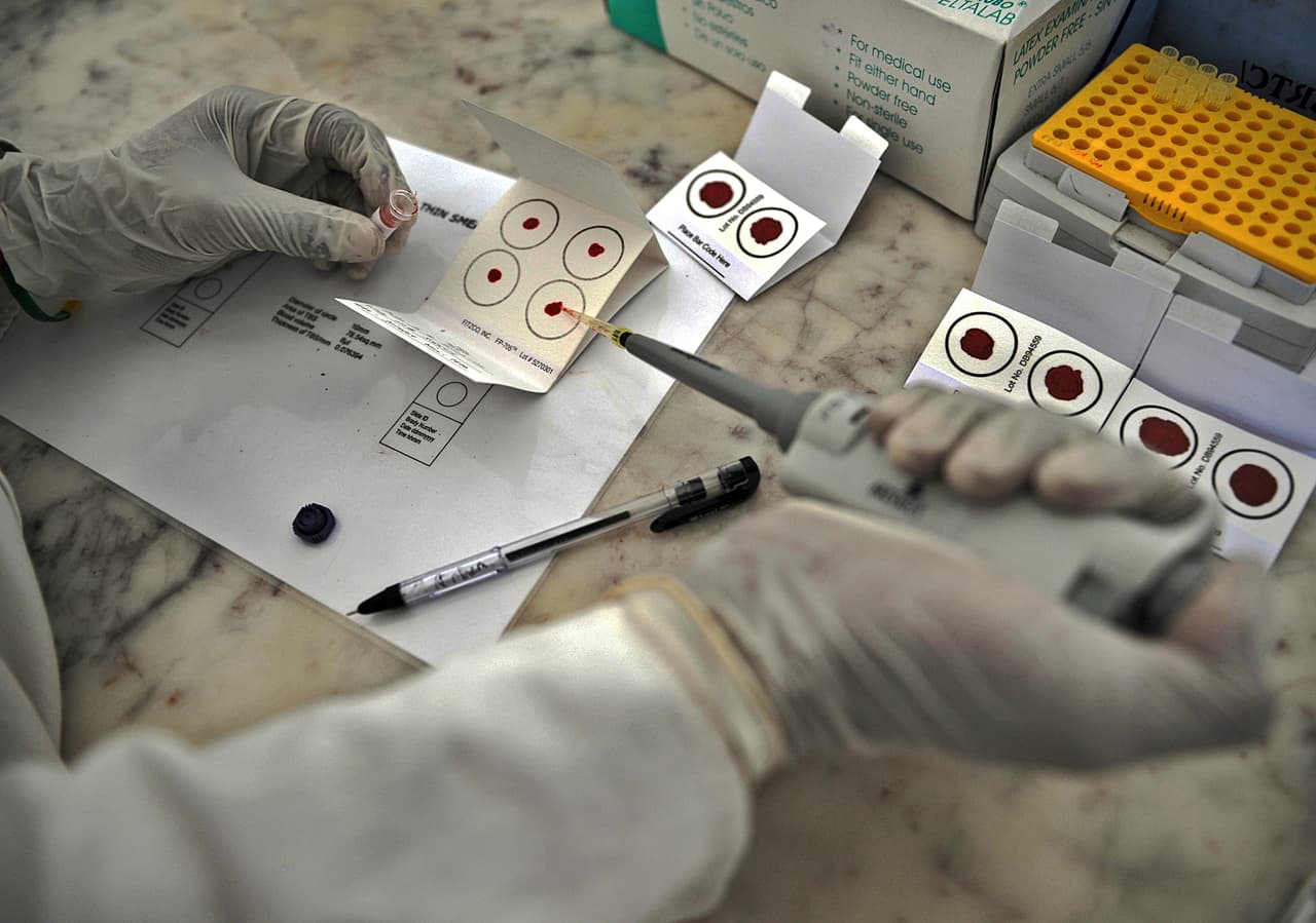 <b>El tratamiento más prometedor es la terapia génica</b>, a través de la cual se podría modificar o reparar el gen dañado que causa la hemofilia. 
<a href="https://www.nhlbi.nih.gov/health-topics/hemofilia">De acuerdo al NHLBI,</a> esta terapia aún no se ha perfeccionado, pero los investigadores la siguen ensayando en estudios clínicos.