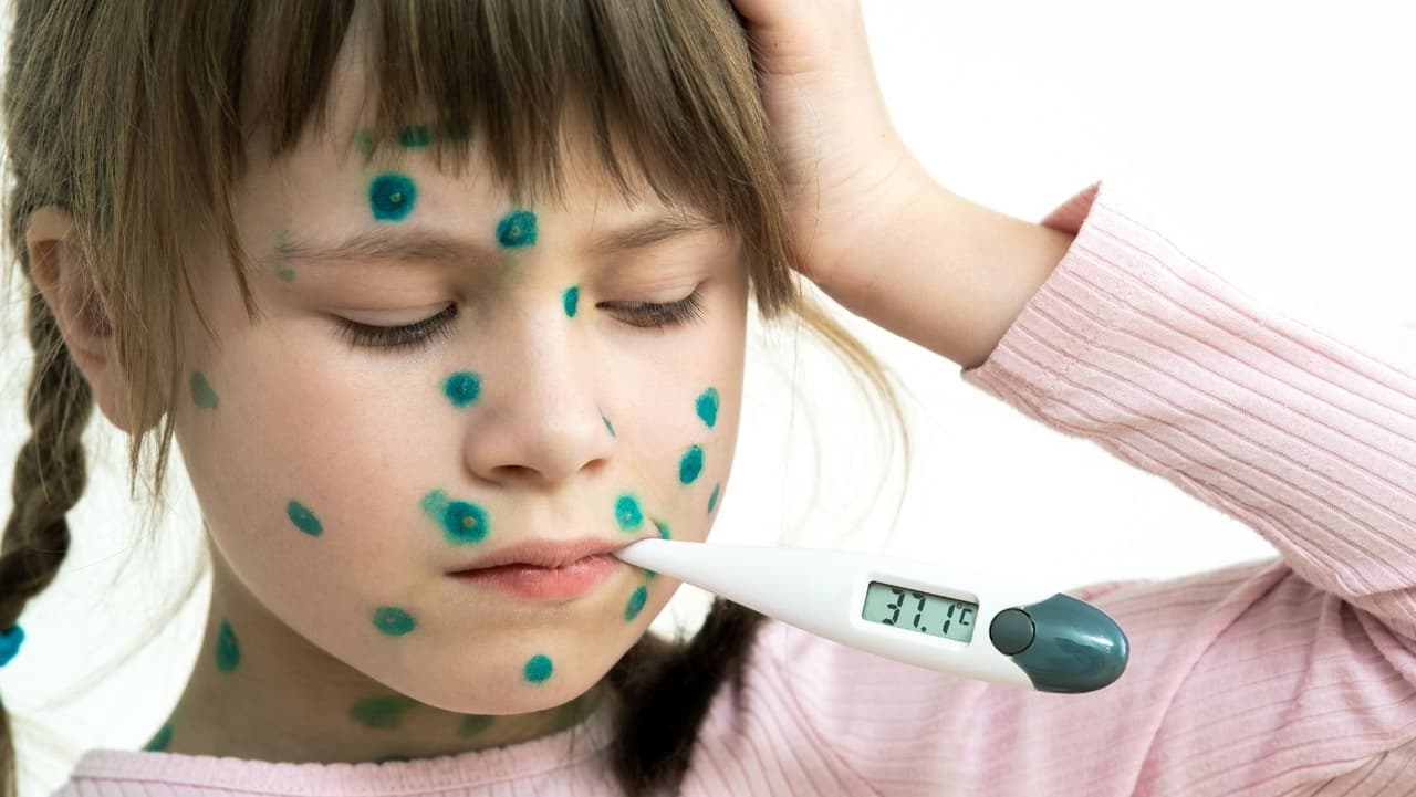 <b>¿Estamos en riesgo de contagios todos?</b>
<br>
<br>No, ni en escuelas, trabajos, gimnasios, supermercados, restaurantes, hoteles, iglesias, transporte público no hay altos riesgos de contagios a menos que exista un contacto directo con las lesiones de una persona infectada.
<br>