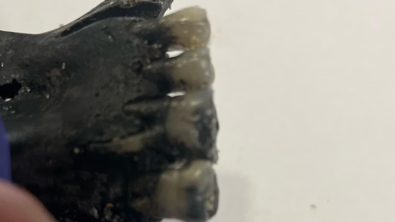 Basándose en los dientes, el patólogo dijo que podría ser la mandíbula de un ser humano. El patólogo también clasificó el hueso como "histórico" y dijo que la persona probablemente no vivió en los tiempos modernos. 
<br>