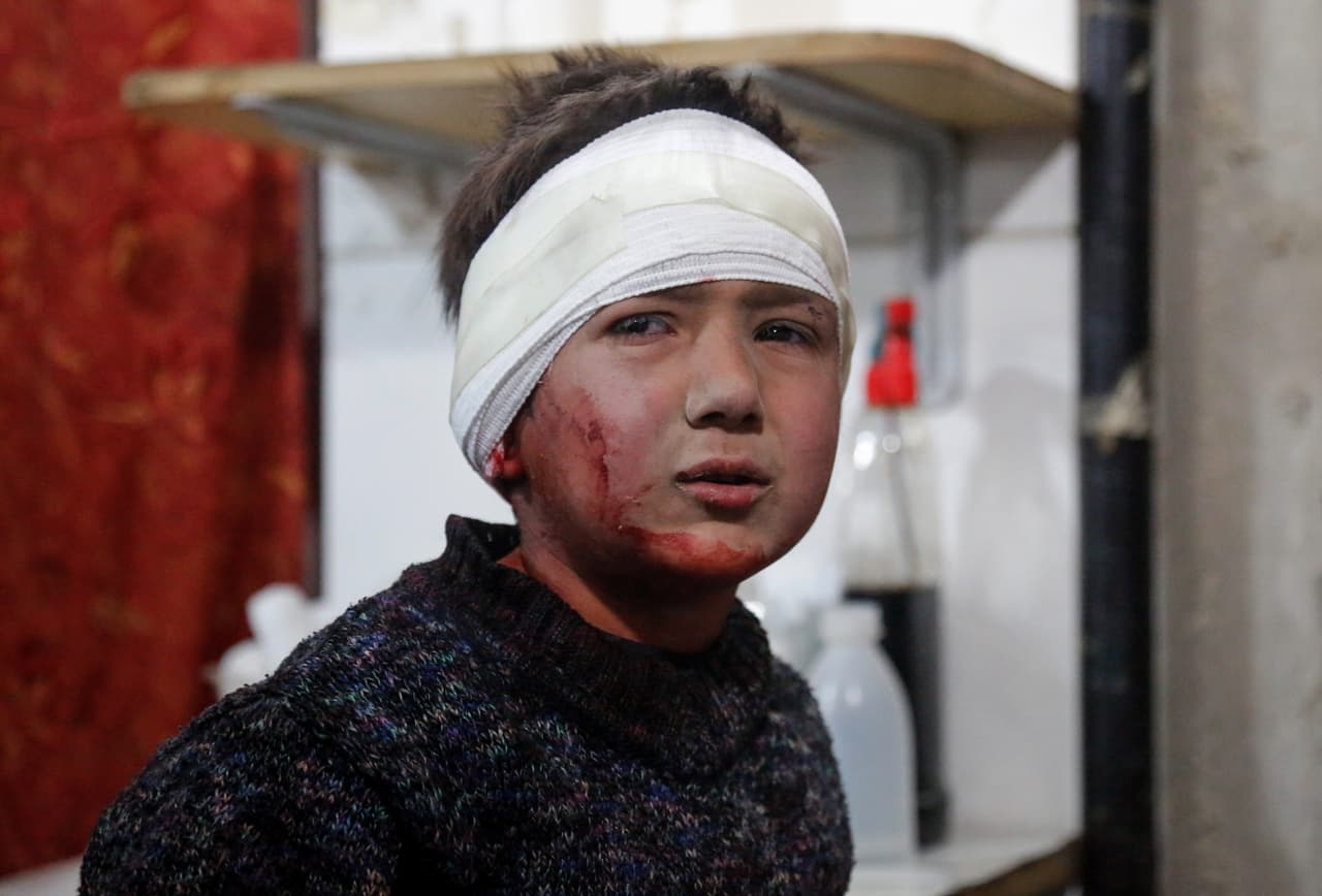 5 de marzo. Un niño sirio herido después de un ataque aéreo de Asad en zonas residenciales en la ciudad de Kafr Batna, Guta Oriental. Los ataques del gobierno sirio continuaron a pesar del alto el fuego acordado el 24 de febrero.