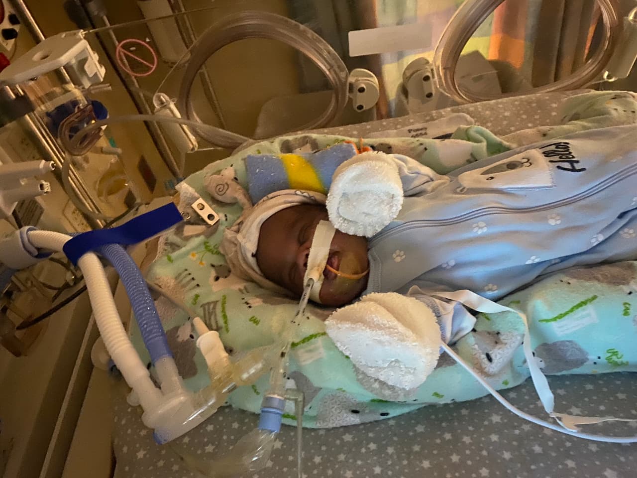 Curtis "nació como un luchador", cuentan en el hospital. Contra todo pronóstico, el bebé se hizo cada vez más fuerte y fue dado de alta después de 275 días en el hospital.