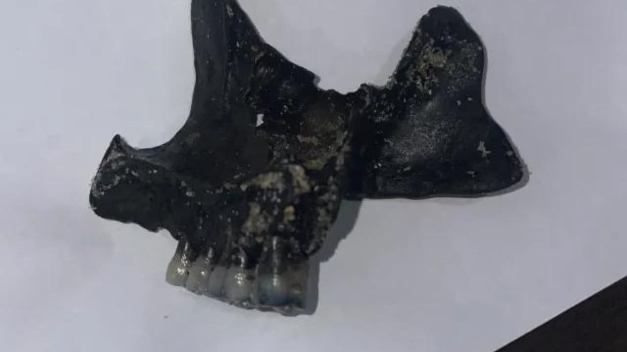 Los funcionarios llamaron a la Oficina del Médico Forense del Estado y enviaron fotografías de la mandíbula.
<br>