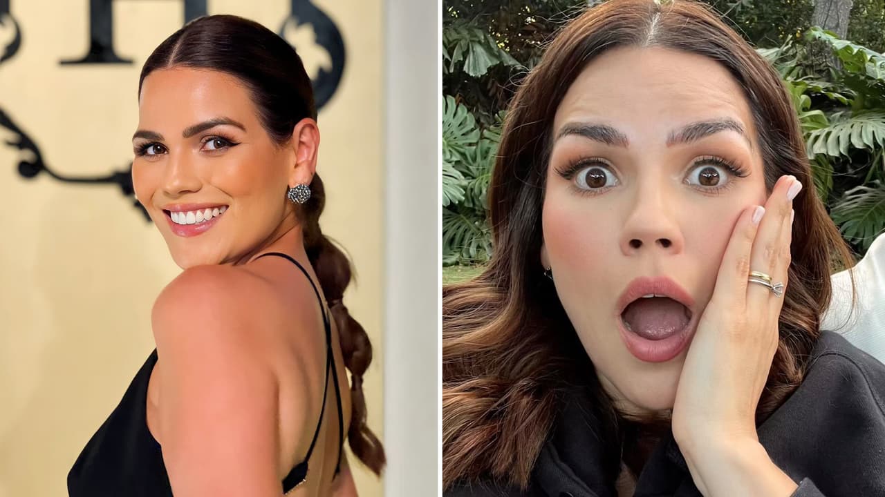 Karina Banda se quita tratamiento estético de la cara y se sorprende con el cambio: “¡Soy otra!”  