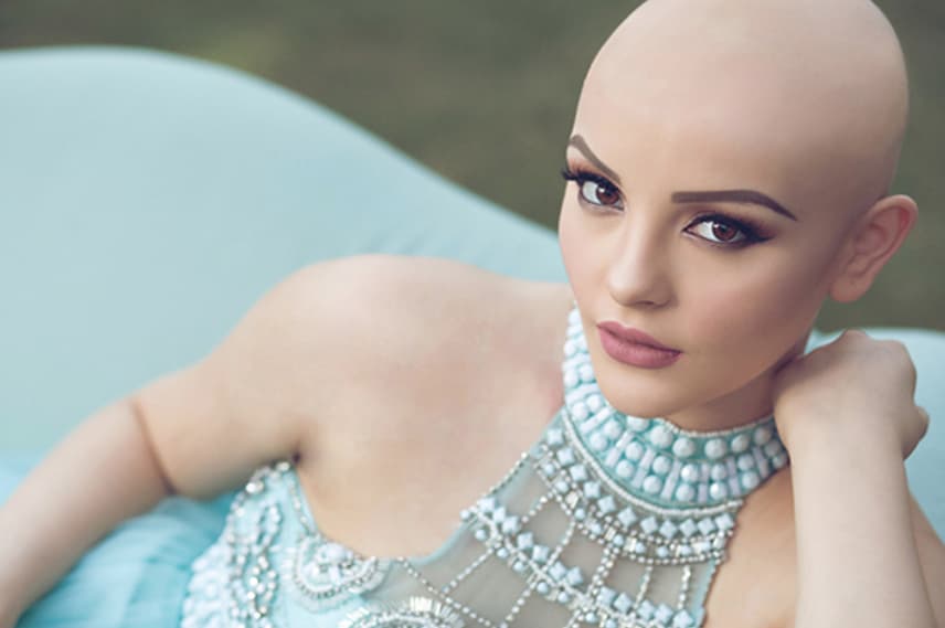 "El cáncer no me impide ser una princesa", la valentía de la adolescente que se mostró sin pelo