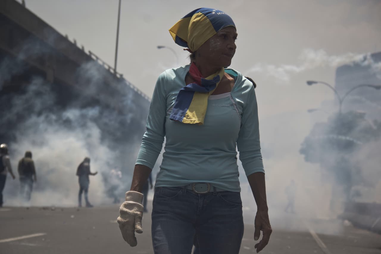 Con la mano derecha enguantada, para poder lanzar las bombas lacrimógenas hirvientes de regreso a la policía. 19 de abril de 2017.