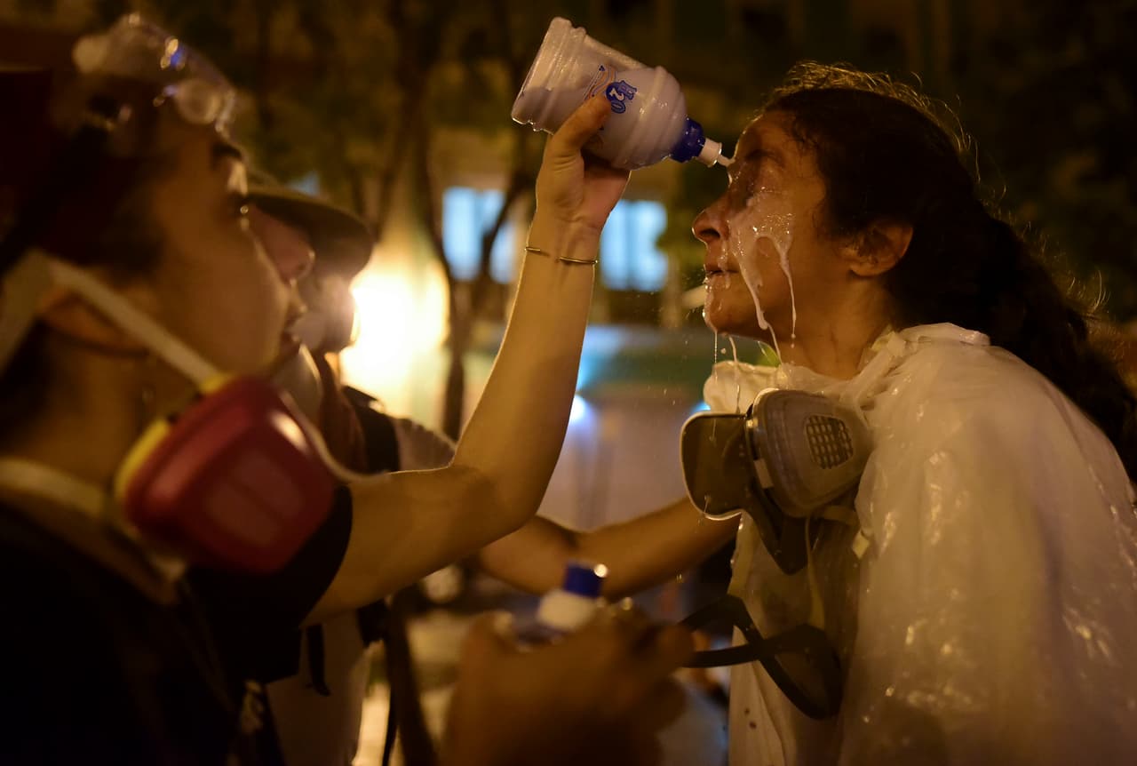 La fotoperiodista Ana María Abruña recibe una solución casera luego de ser expuesta a gases lacrimógenos durante las protestas. 
<br>