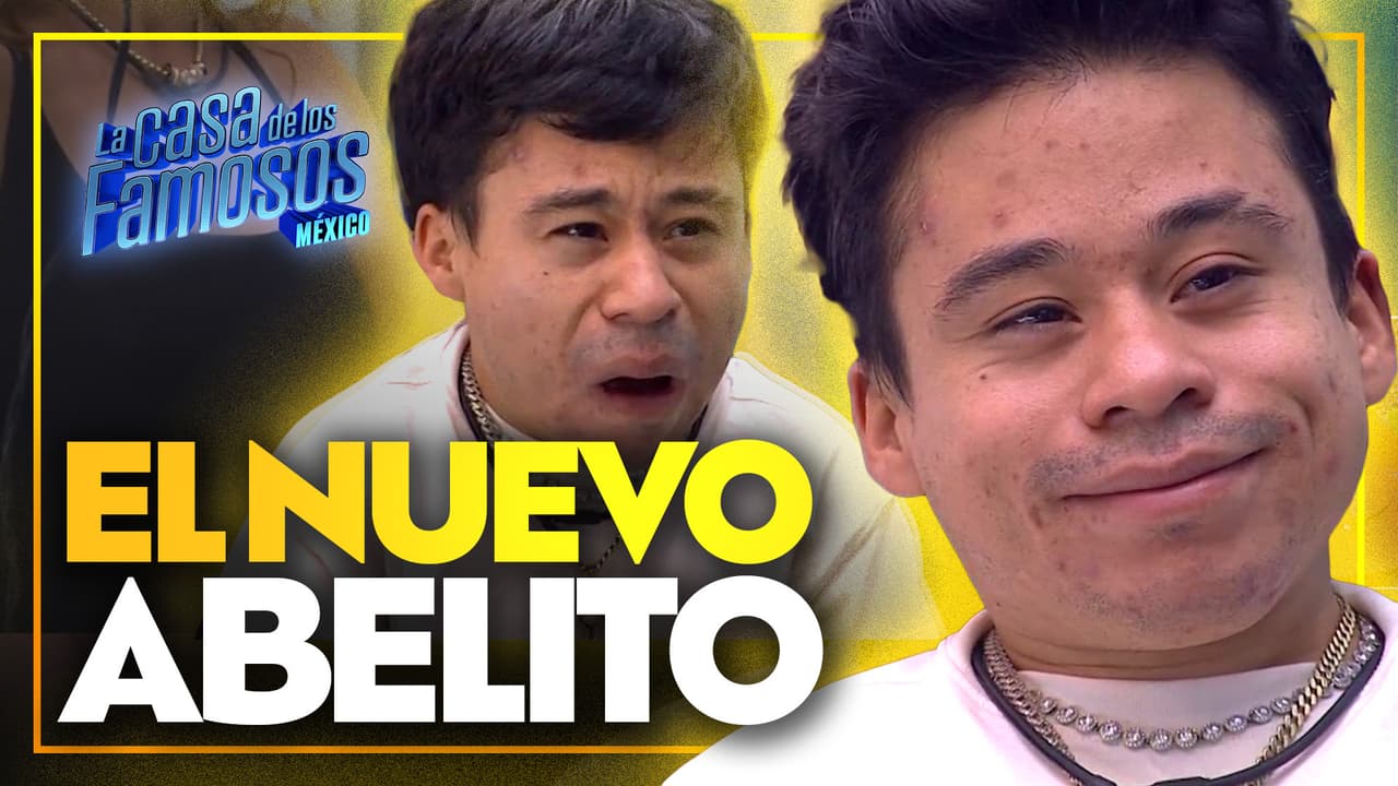 Entre quemaduras y reclamos, Abelito luce cambio de imagen e impacta a todos