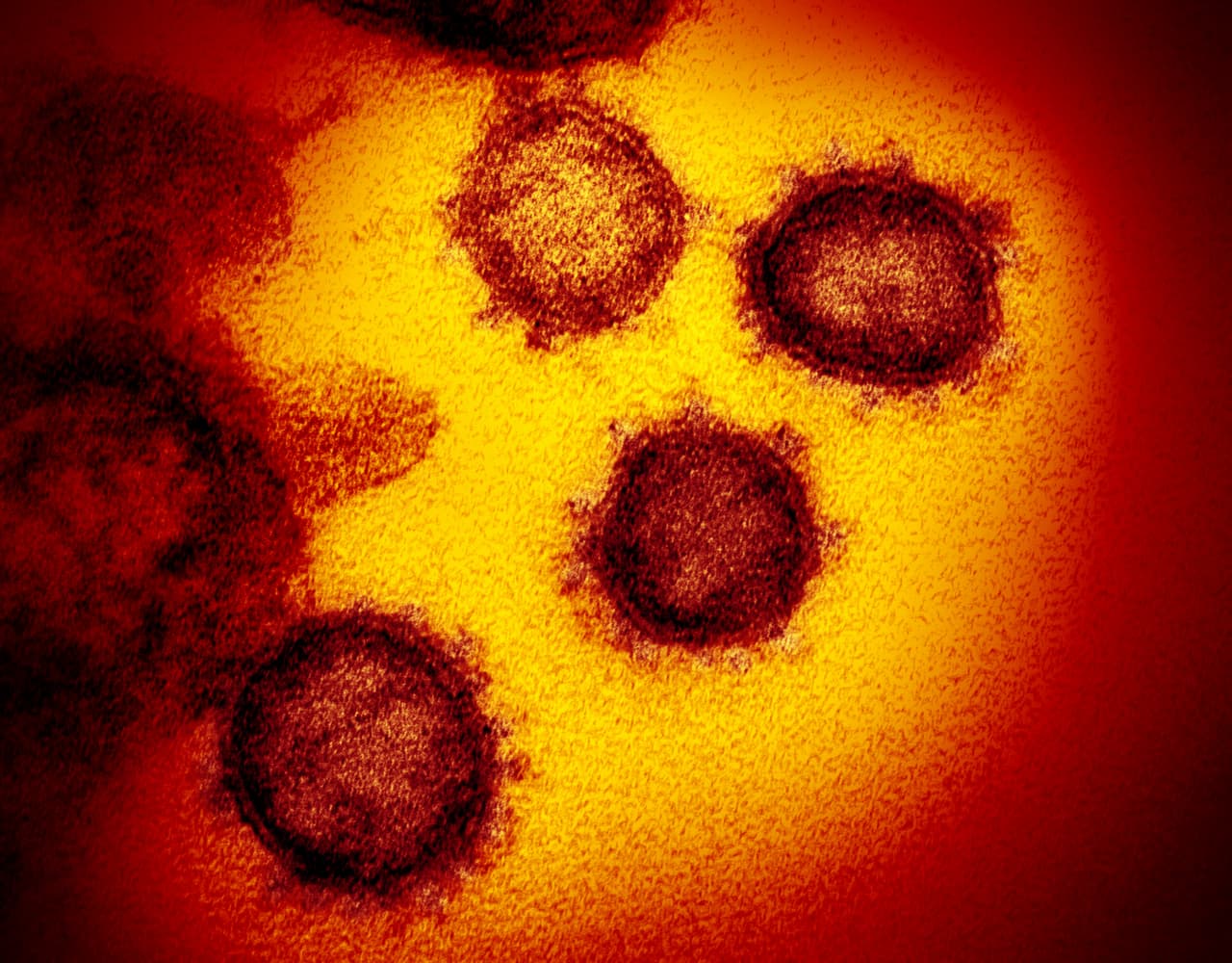<b>La foto oficial del coronavirus y nombre de la efermedad (19 de febrero). </b>El 
<a href="https://www.niaid.nih.gov/news-events/novel-coronavirus-sarscov2-images">Instituto Nacional de Alergias y Enfermedades Infecciosas de EEUU</a> (NIAID, por sus siglas en inglés), publicó las primeras fotografías del SARS-CoV-2, que 
<a href="https://www.univision.com/noticias/salud/las-razones-del-nombre-del-coronavirus-7-impresionantes-imagenes-que-te-lo-explican-fotos">muestran la corona que le da su nombre</a>. El 11 de febrero la OMS dio el nombre oficial a la enfermedad: 
<a href="https://www.univision.com/temas/coronavirus"><u>covid-19</u></a>, especialmente creado sin referencias geográficas o de animales.