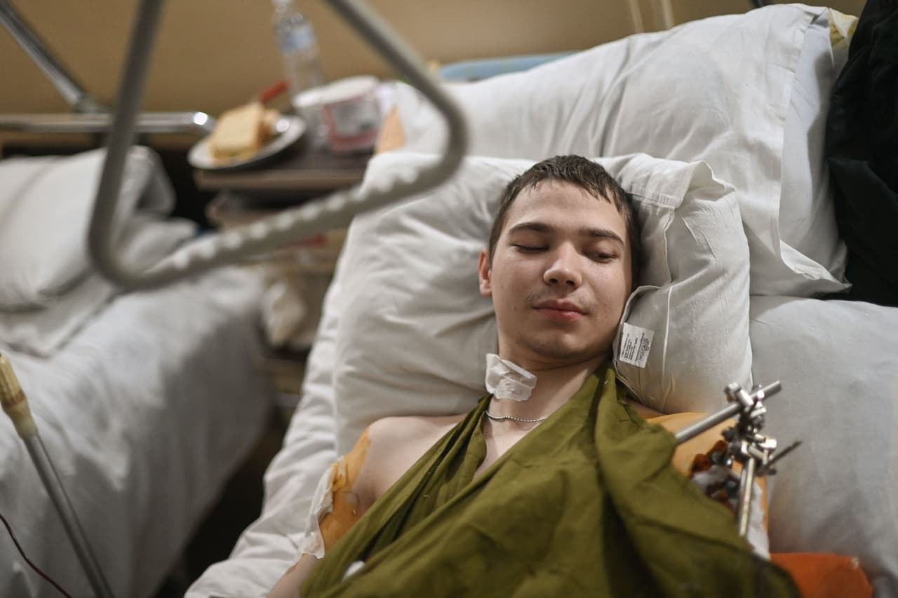 Un vocero del Departamento de Defensa de Estados Unidos dijo este miércoles que es posible los comandantes rusos puedan estar reagrupando a su personal y repensando sus planes de ataque. En la imagen un soldado ucraniano de corta edad en un hospital de su país.