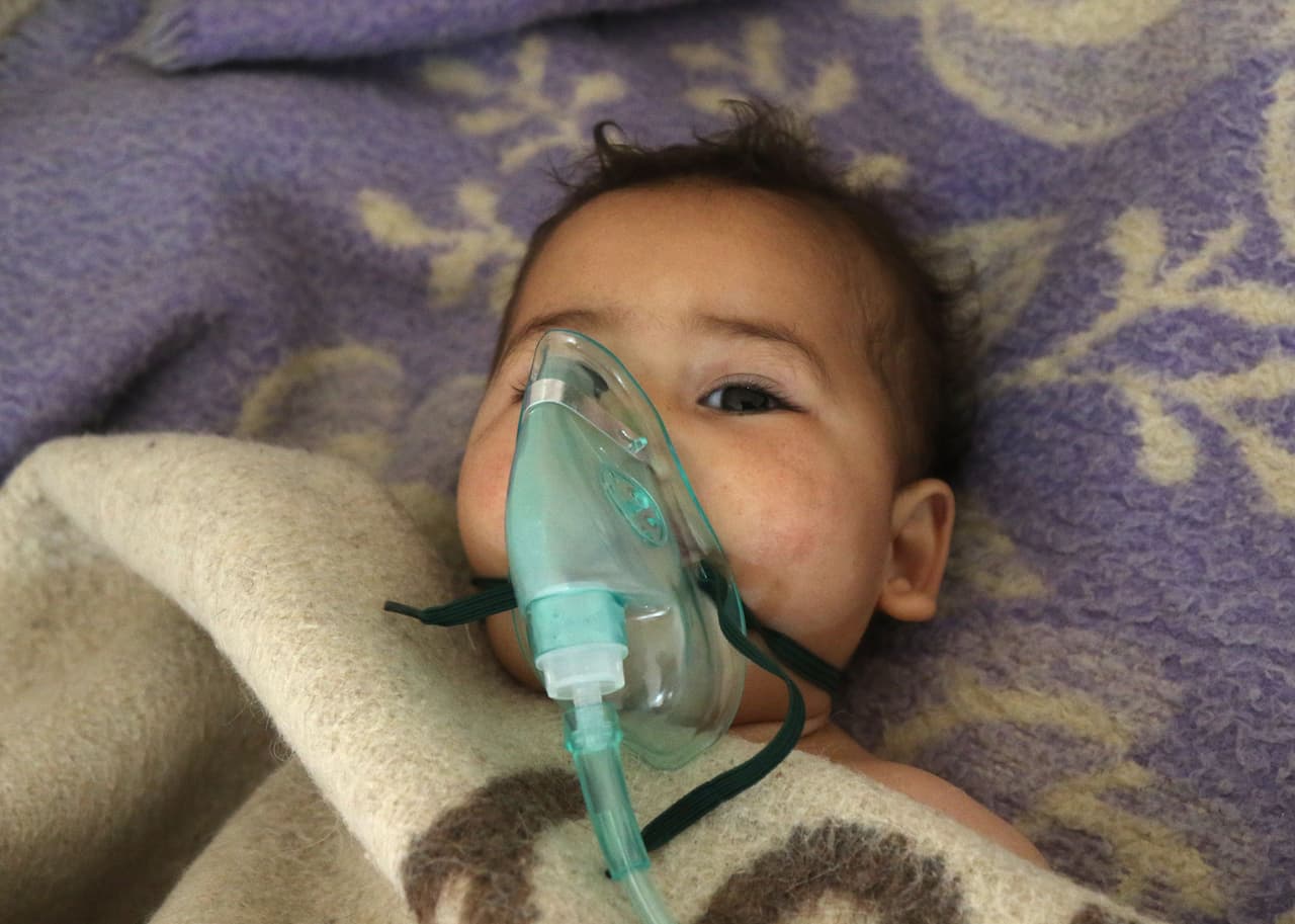 Un pequeño recibe tratamiento en un pequeño hospital en la ciudad de Maaret al-Noman tras un presunto ataque de gas tóxico en Khan Sheikhun, una ciudad cercana controlada por rebeldes sirios. 4 de abril de 2017.