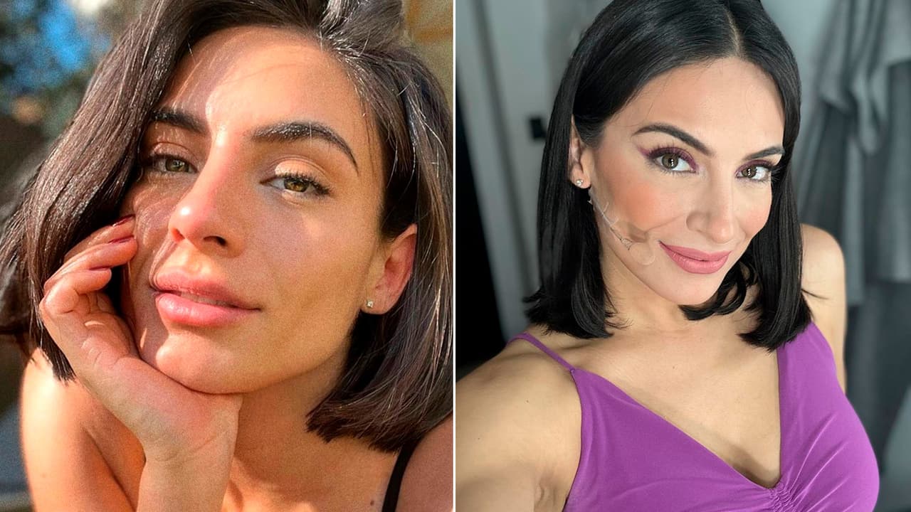 Ana Brenda Contreras muestra que se quitó los implantes mamarios: compartió fotos desde el hospital