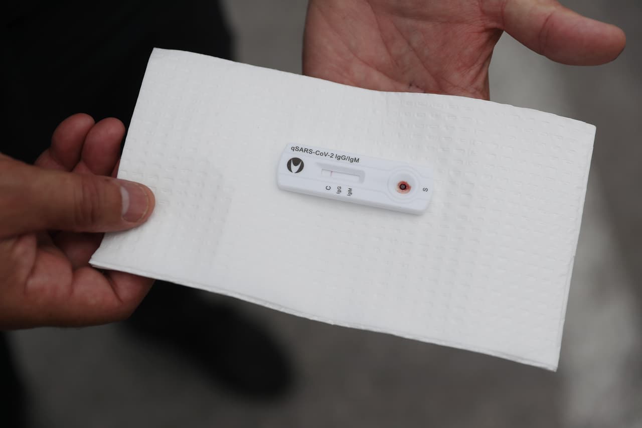 “Los anticuerpos forman parte de nuestro mecanismo de defensa y se forman después de la exposición. Permiten identificar los portadores sanos, que es el paciente asintomático que se ha vuelto realmente un problema en esta epidemia”, explica la epidemióloga Dadilia Garcés