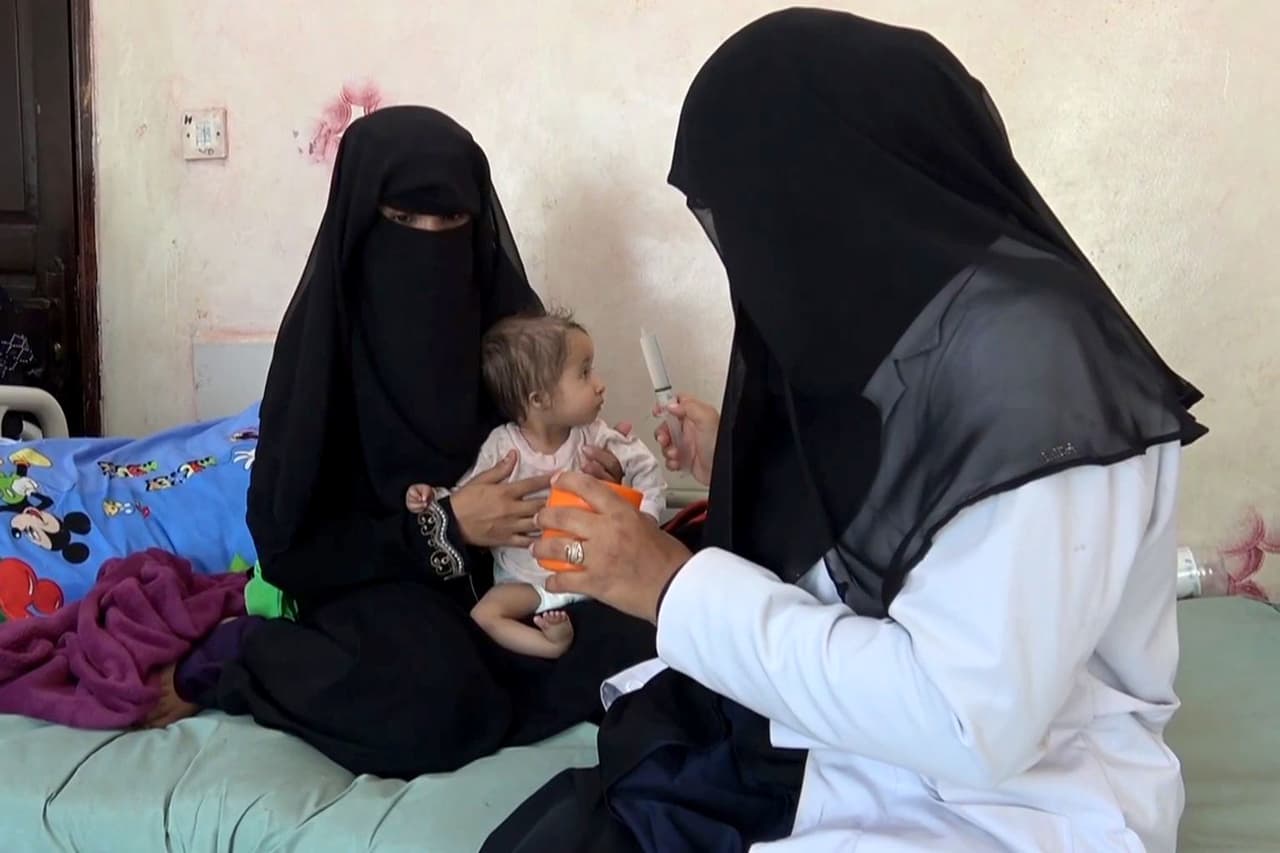 Una madre yemení sostiene a su hijo desnutrido mientras una enfermera trata de alimentarlo en un hospital de Taez el 19 de noviembre de 2018. “Los niños que mueren de esta manera sufren enormemente a medida que las funciones de sus órganos vitales disminuyen la velocidad y finalmente se detienen”, explicó la ONG.