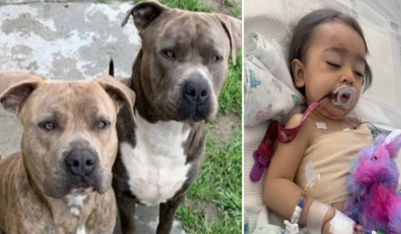 “Sigan rezando por mi nieta. No está fuera de peligro”: abuela de bebé de 1 año atacada por perros pitbull 