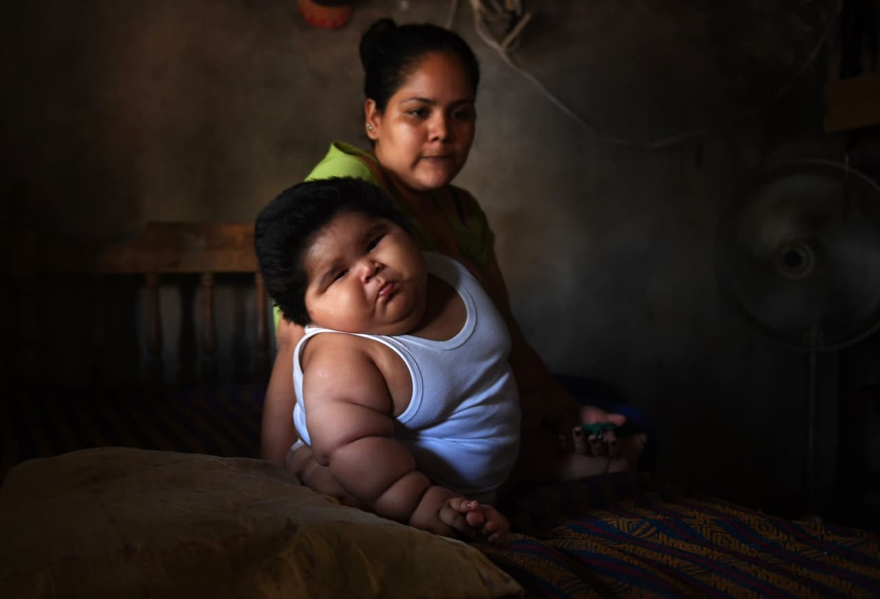 Orozco aguarda a que los análisis digan que el niño no padece Prader-Willi y que su aumento de peso se deba a una "inflación celular" provocada por falta de nutrientes que la madre pudo haber tenido durante el embarazo, provocando “bajo funcionamiento tiroideo, y de sus glándulas suprarrenales encargadas del metabolismo". En ese caso el tratamiento sería hormonal, dice Orozco.