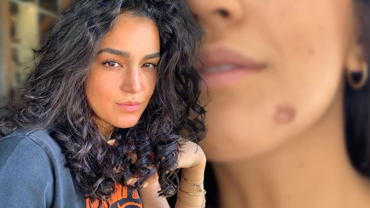 “Se llevó la piel”: hija de Biby Gaytán y Eduardo Capetillo se quemó el rostro mientras cocinaba