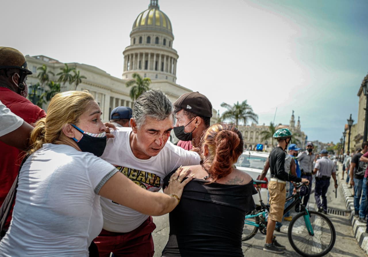 Un hombre se ve en esta imagen con una herida en el ojo, con el capitolio cubano a sus espaldas.