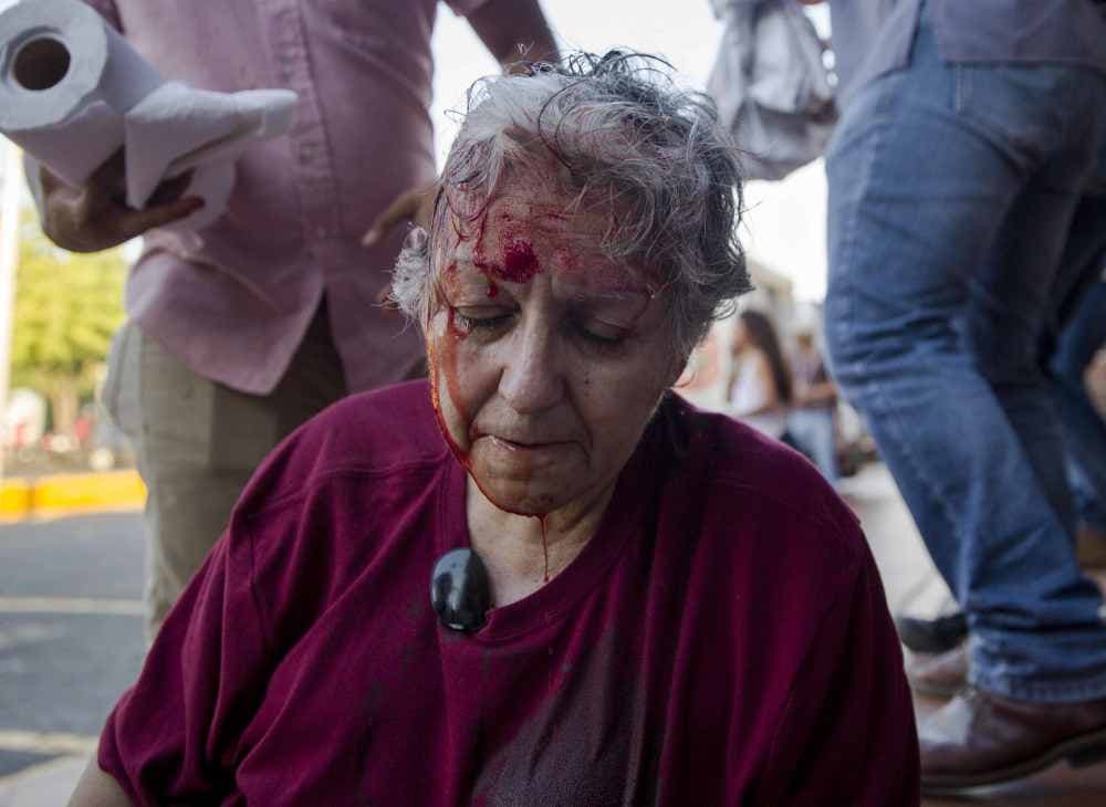 Ana Quiroz, activista de la Red de Mujeres contra la Violencia, fue herida por un grupo de enmascarados cuando protestaba contra la reforma a la Seguridad Social en Managua.