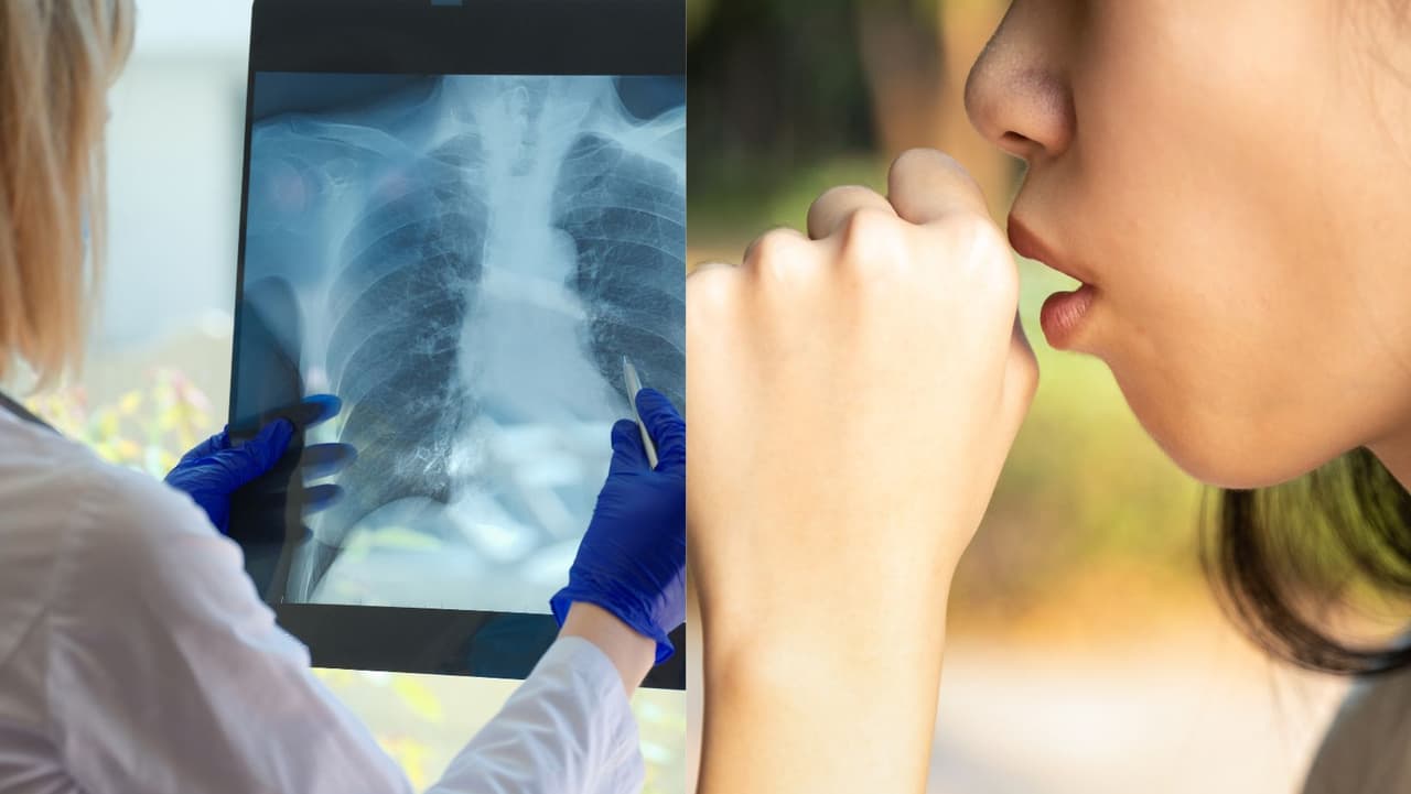 Los hospitales se preparan para más casos de enfermedades respiratorias y así puedes prevenirlas 
