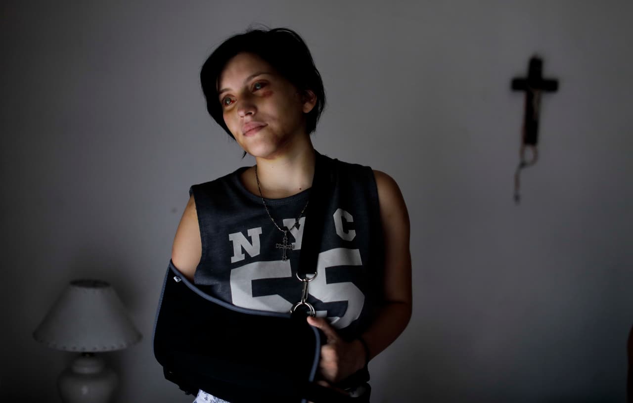 Belén Torres comenzó su a trabajar como asistente administrativa de un anestesiólogo en Buenos Aires, con el fin de ayudar a su familia. A los pocos días fue golpeada por su jefe, quien luego de invitarla a drogarse con él, intentó forzarla a mantener relaciones sexuales. Luego de ser golpeada, Belén logró escapar y salir, y un desconocido llamó a las autoridades.