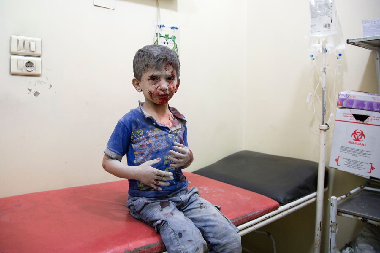 Un niño sirio herido espera tratamiento en un hospital de una zona controlada por los rebeldes, el 24 de septiembre de 2016.