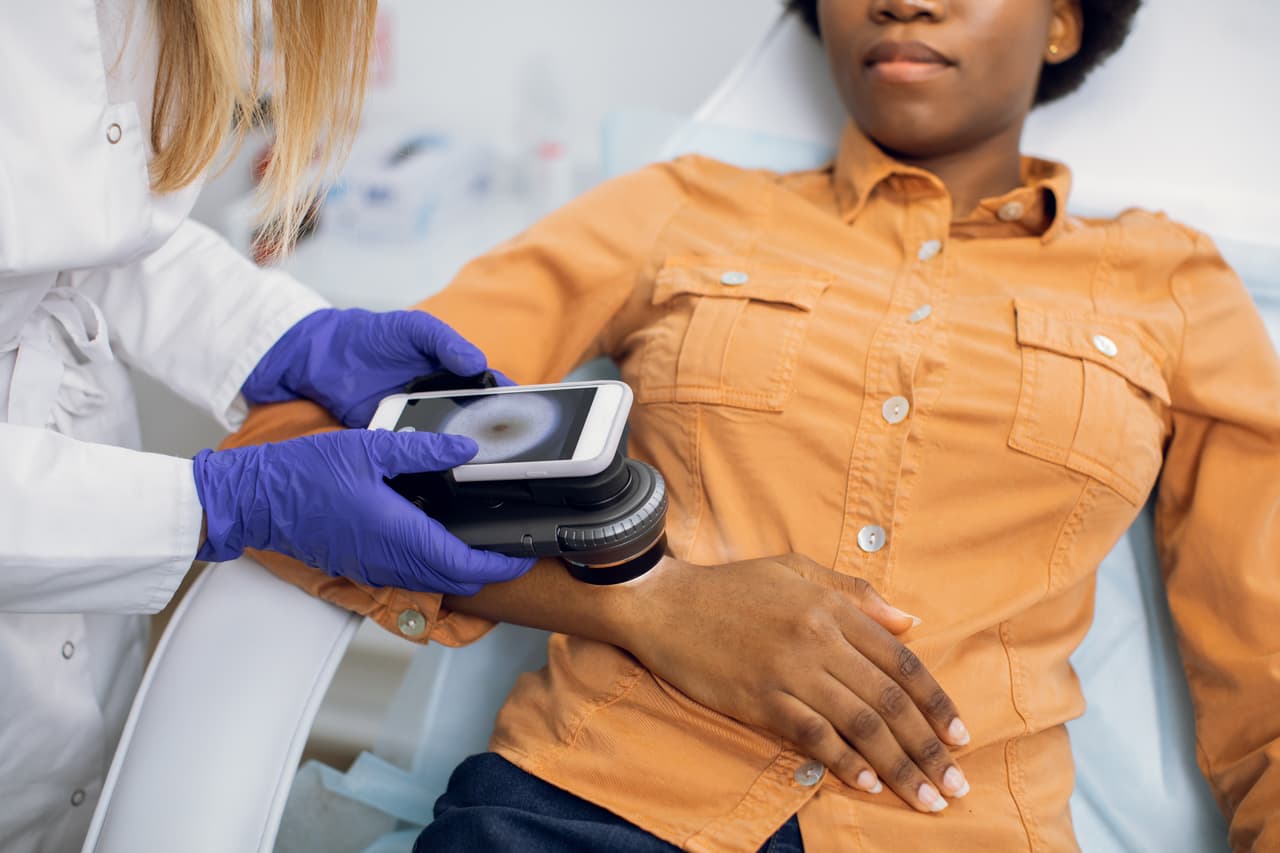 El cáncer de piel, un riesgo para todos, puede pasar inadvertido en pieles oscuras 