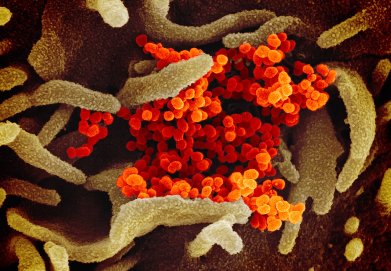Según un comunicado de NIAID, las imágenes son el resultado de los estudios de Emmie de Wit, investigadora de la institución. La microscopista Elizabeth Fischer produjo las fotos y la oficina de artes visuales médicas las coloreó digitalmente.