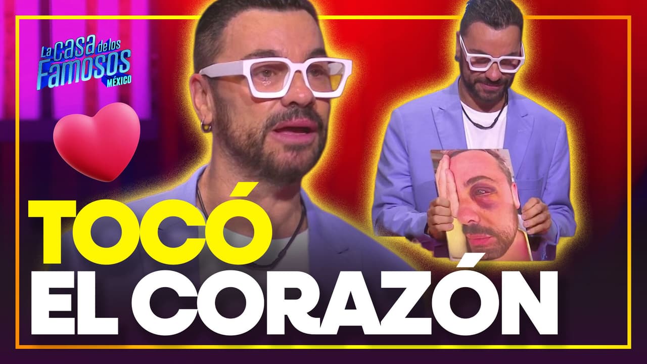 Shiky narra cómo perdió la vista de un ojo por una operación estética