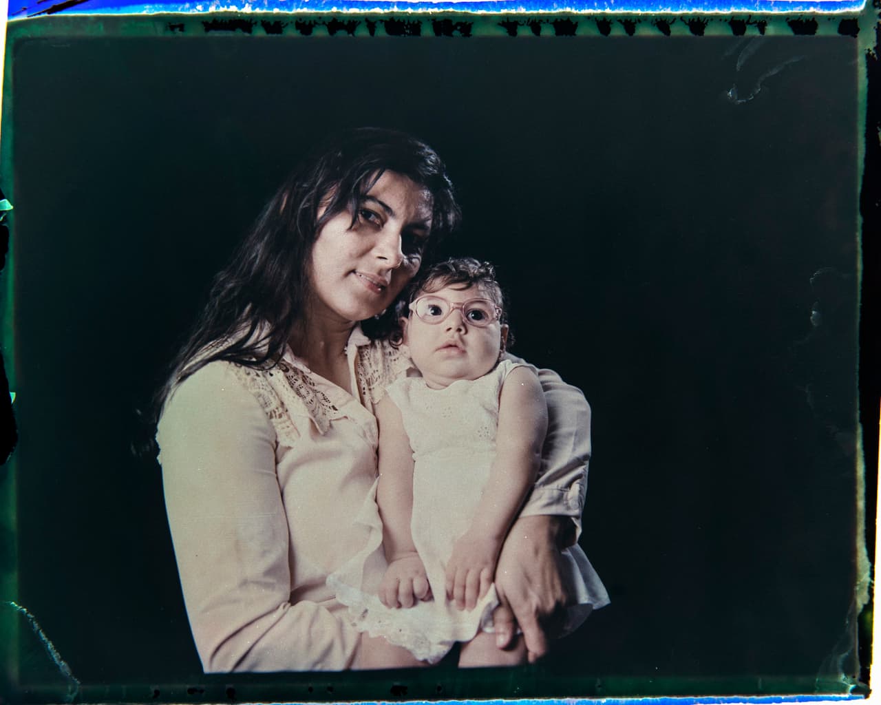 Luhandra Da Silva solía poder sentarse erguida y comer sólidos sin problemas, pero una convulsión la dejó paralizada. Ahora su mamá, Jusikelly Da Silva está desesperada por hacerle un estudio cerebral. Aunque existen muchas 
<a href="http://www.univision.com/noticias/virus-del-zika/en-fotos-dispositivos-y-otros-inventos-para-protegerse-del-zika-fotos"><u>maneras de protegerse</u></a> contra el virus del Zika, miles de mujeres embarazadas han sido afectadas en Brasil y en 
<a href="http://www.univision.com/noticias/virus-del-zika/detectan-primer-caso-de-microcefalia-en-venezuela-asociado-al-zika"><u>América Latina</u></a>