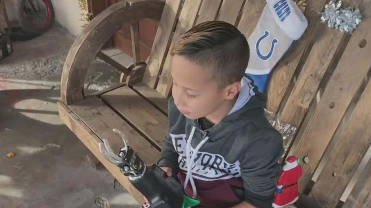 <b>Televidentes cumplen el sueño de Navidad de este niño que construía sus prótesis con lego</b>
<br>
<br>Damián Rivera jugaba a crear una prótesis para su brazo con piezas de lego. Soñaba que algún día alguien lo ayudaría a conseguir una. Este anhelo se hizo realidad.