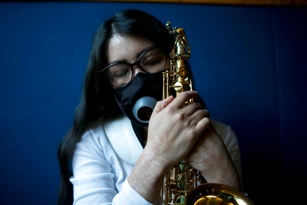 Seguirá en la cárcel presunto agresor con ácido de saxofonista mexicana