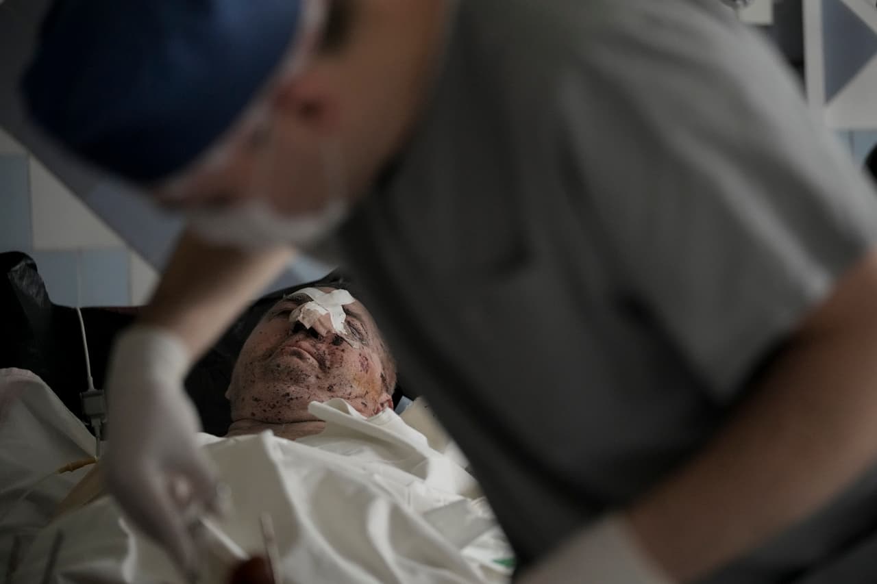 Médicos en un hospital de Brovary, al norte de Kiev, atienden a un hombre que sufrió heridas de gravedad después de que el vehículo en el que huía de su pueblo pisara una mina. El lento avance de las tropas rusas ha llevado a que Moscú 
<a href="https://www.univision.com/noticias/mundo/tactica-militar-guerra-rusia-ucrania-aterrorizar-poblacion-civil-fotos">aumente el asedio</a> sobre varias ciudades; más de 20 centros médicos han sido alcanzados por los ataques.