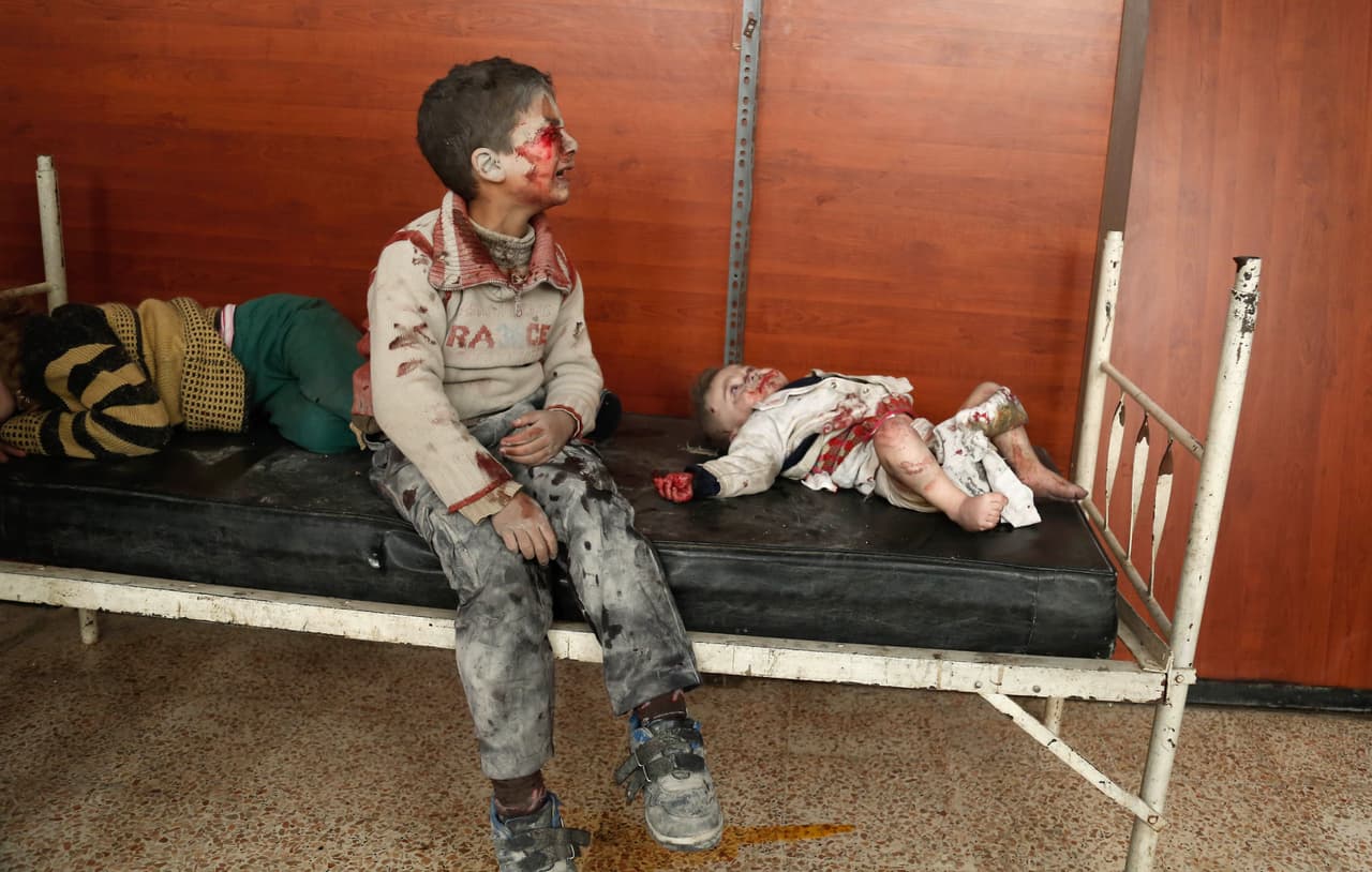 Niños sirios en un hospital, después de un ataque aéreo a su ciudad. 25 de marzo de 2017.