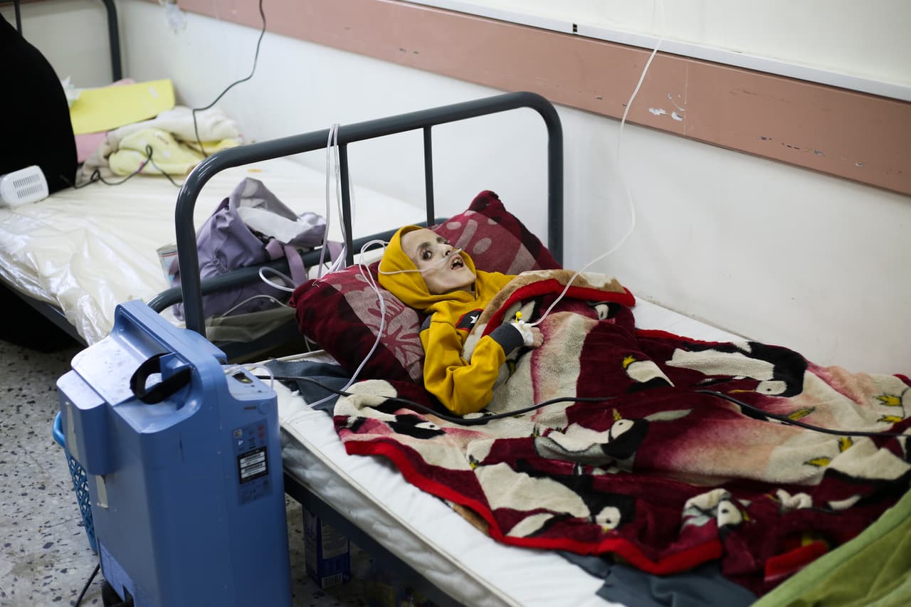 Esta foto muestra al niño palestino de 10 años Yazan al-Kafarna cuando se encontraba en un hospital de Rafah el pasado domingo 3 de marzo de 2024. Yazan murió al día siguiente debido a lo que su médico dijo era un desgaste muscular extremo causado principalmente por falta de alimento. (Foto AP/Hatem Ali)