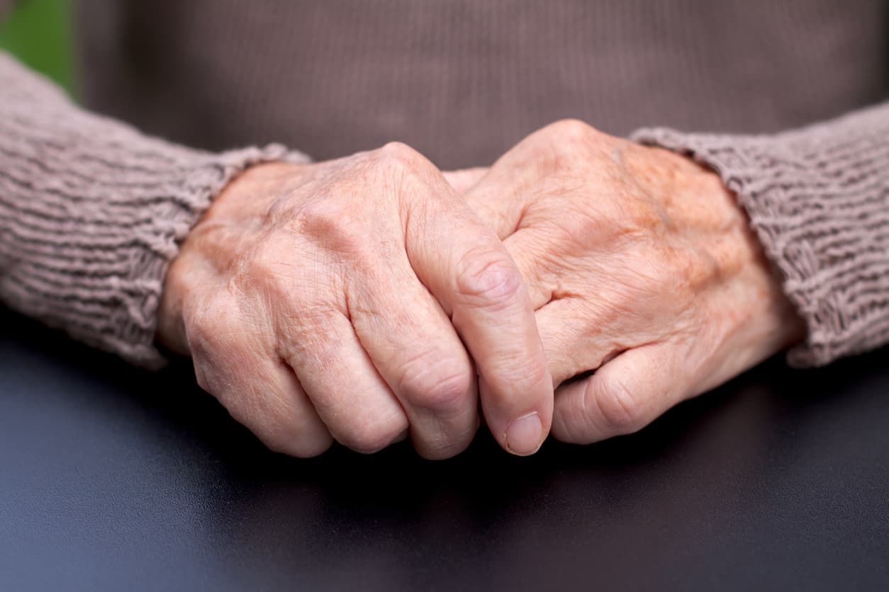 <b>Acrocianosis.</b> La acrocianosis se produce principalmente en las manos, aunque también, en menor medida, en los pies. Los síntomas son dedos fríos y de color azulado. También se produce sudoración en forma abundante.