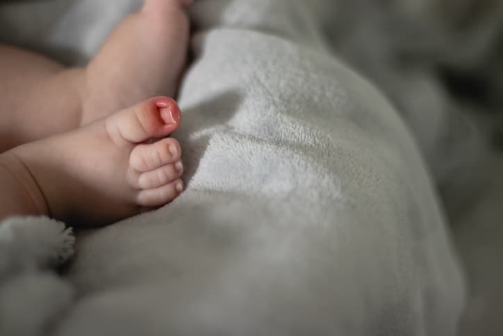 Lo que debes saber sobre el raro y peligroso 'síndrome del torniquete' en bebés 