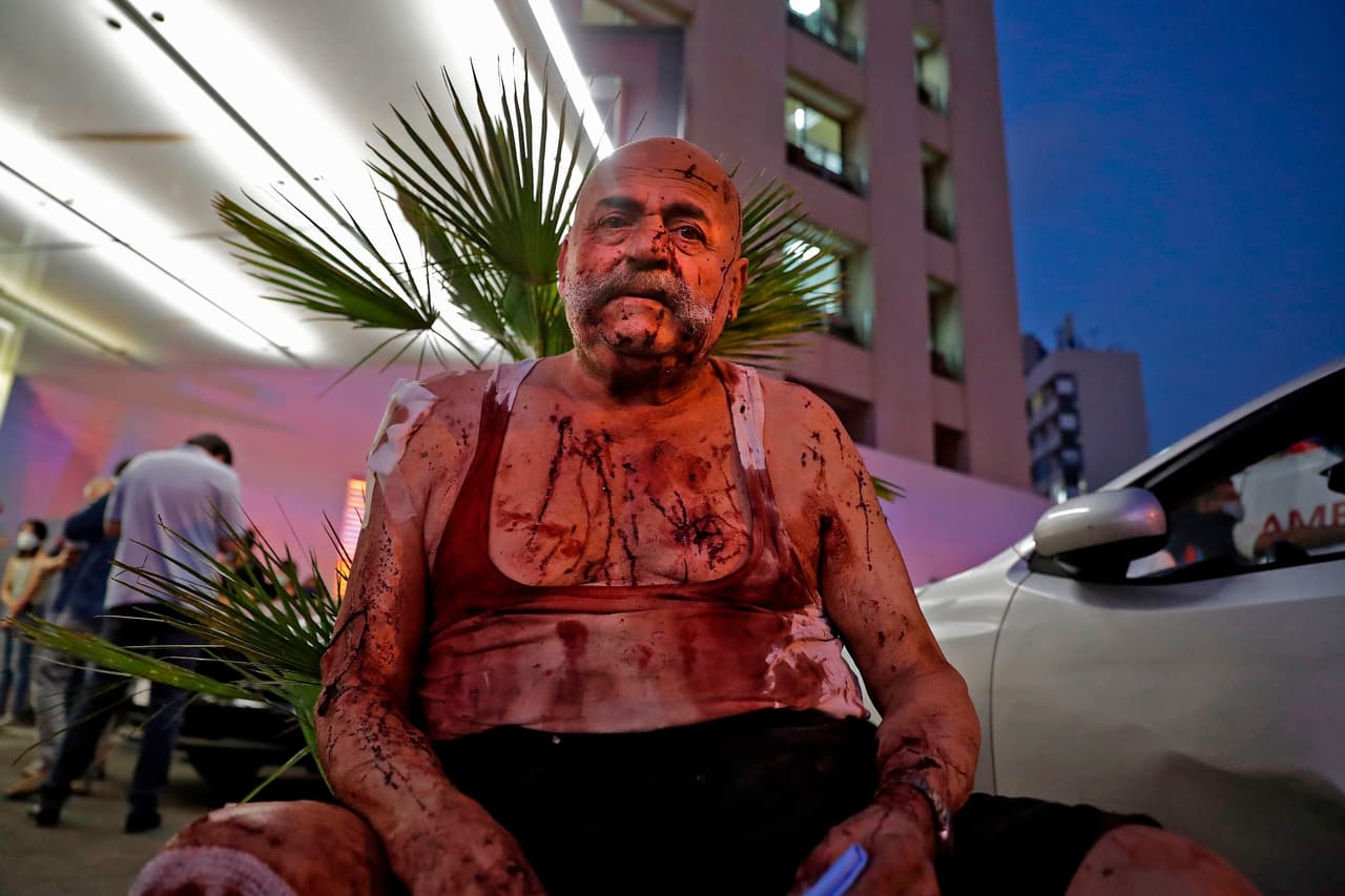 Un hombre herido espera por ayuda fuera de un hospital de Beirut.
<br>